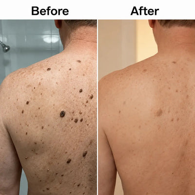 Glycolic Acid Exfoliating Body Stick